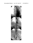 SYSTEM FOR DIAGNOSING MULTIPLE SCLEROSIS diagram and image