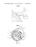  Method Of Treating An Ocular Pathology By Applying High Intensity Focused Ultrasound and Device Thereof diagram and image