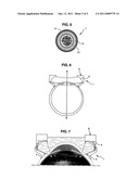  Method Of Treating An Ocular Pathology By Applying High Intensity Focused Ultrasound and Device Thereof diagram and image