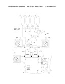 DIALYSIS SYSTEM INCLUDING BLOOD AND DIALYSATE CASSETTE diagram and image