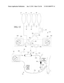 DIALYSIS SYSTEM INCLUDING BLOOD AND DIALYSATE CASSETTE diagram and image