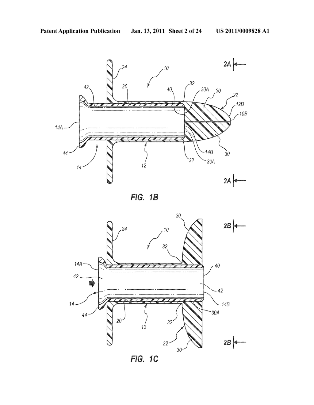 EXTENSIBLE INTERNAL BOLSTER FOR A MEDICAL DEVICE - diagram, schematic, and image 03