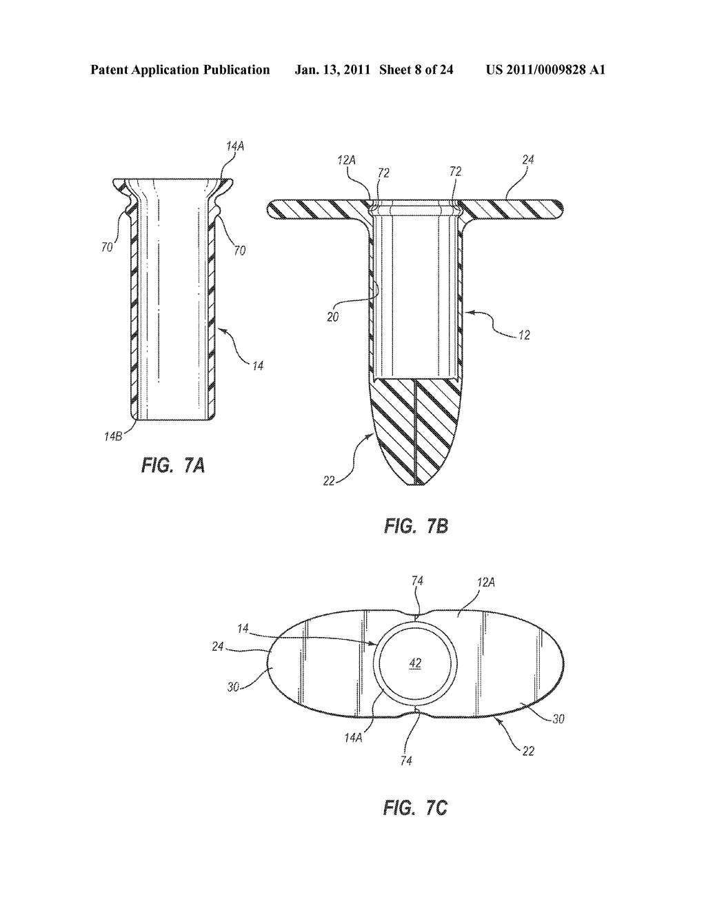 EXTENSIBLE INTERNAL BOLSTER FOR A MEDICAL DEVICE - diagram, schematic, and image 09