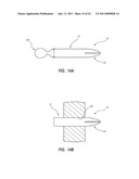 EXTENSIBLE INTERNAL BOLSTER FOR A MEDICAL DEVICE diagram and image