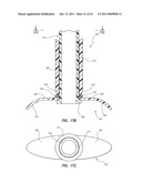 EXTENSIBLE INTERNAL BOLSTER FOR A MEDICAL DEVICE diagram and image