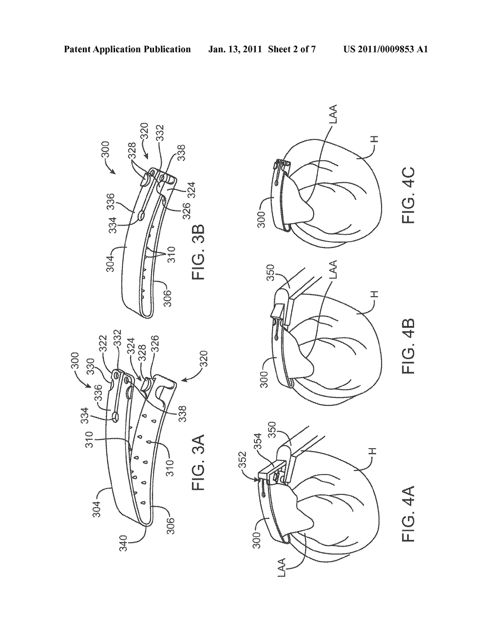 LEFT ATRIAL APPENDAGE DEVICES AND METHODS - diagram, schematic, and image 03