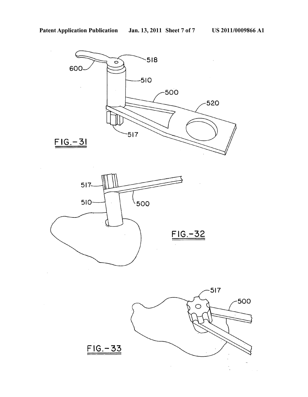 Osteotomy plate, plate driver and method for their use - diagram, schematic, and image 08