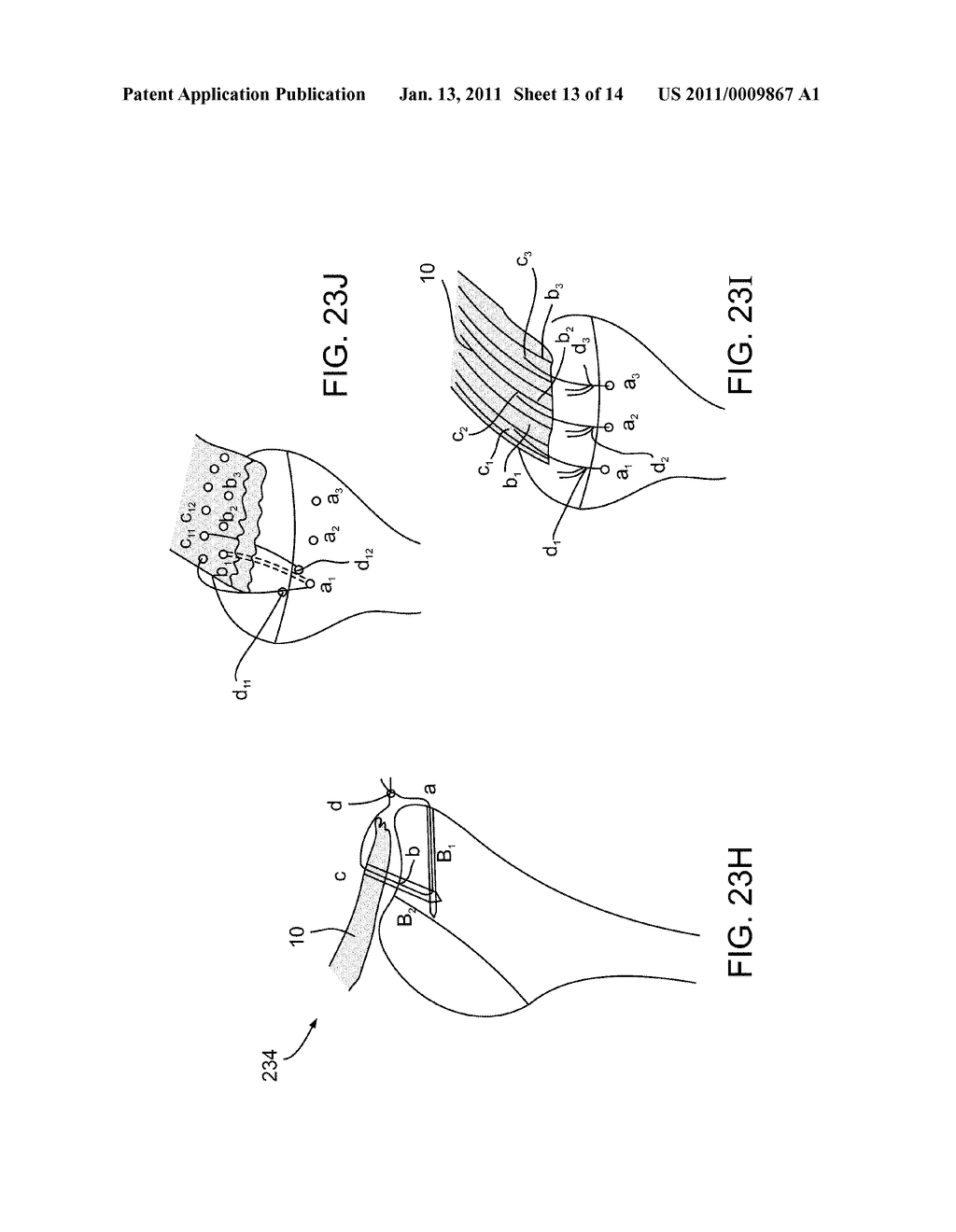 MEDICAL APPARATUS AND METHOD FOR ATTACHING A SUTURE TO A BONE - diagram, schematic, and image 14