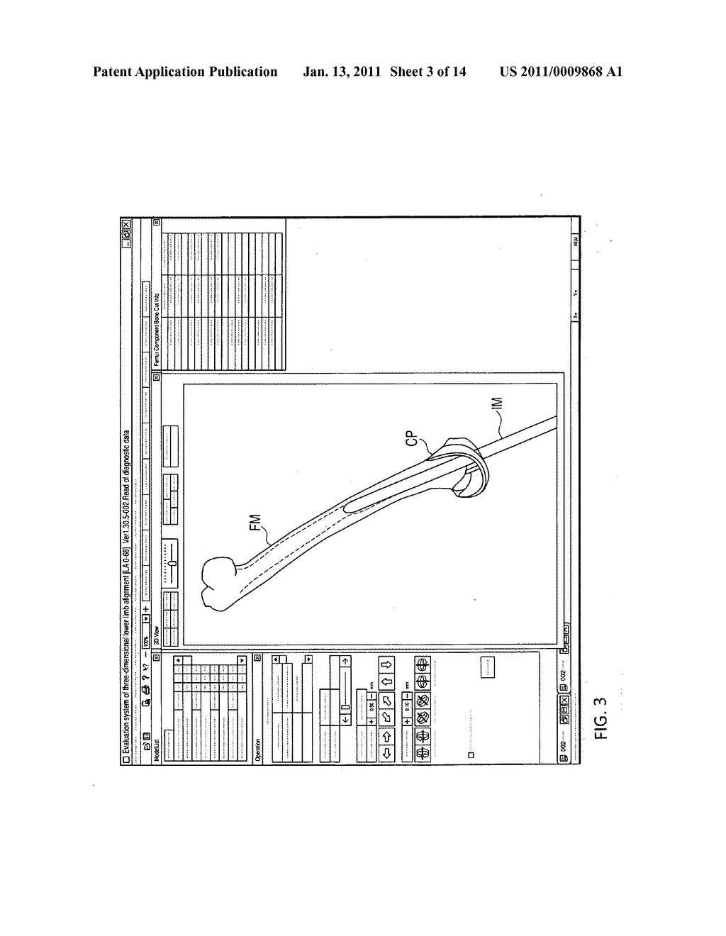 Apparatus for preoperative planning of artificial knee joint replacement operation and jig for supporting operation - diagram, schematic, and image 04