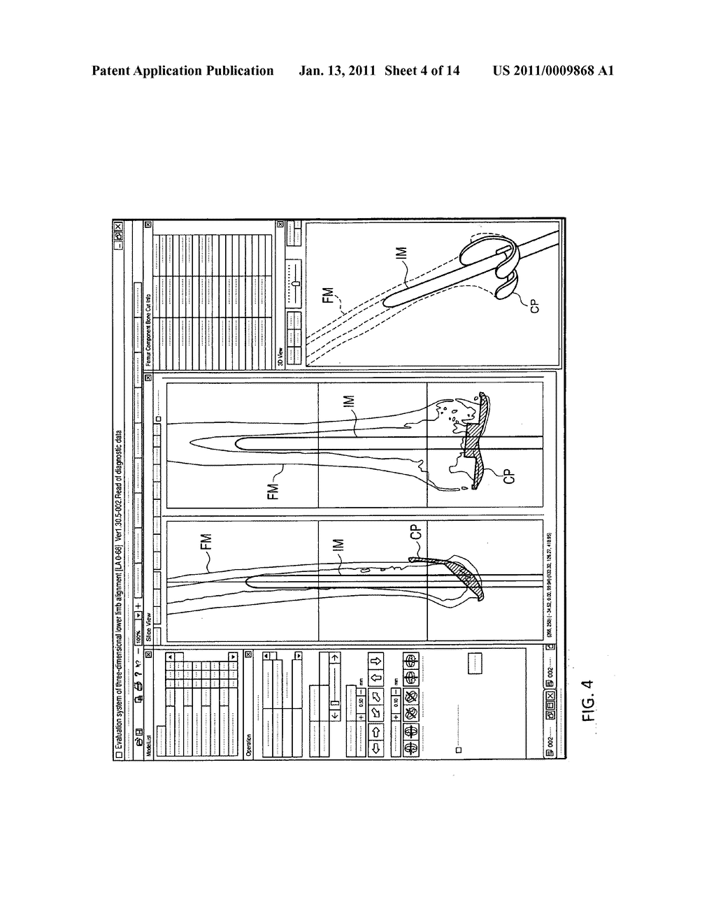 Apparatus for preoperative planning of artificial knee joint replacement operation and jig for supporting operation - diagram, schematic, and image 05