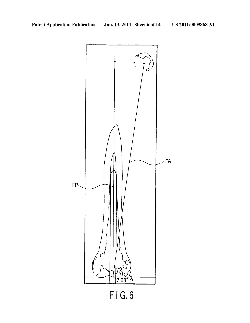 Apparatus for preoperative planning of artificial knee joint replacement operation and jig for supporting operation - diagram, schematic, and image 07