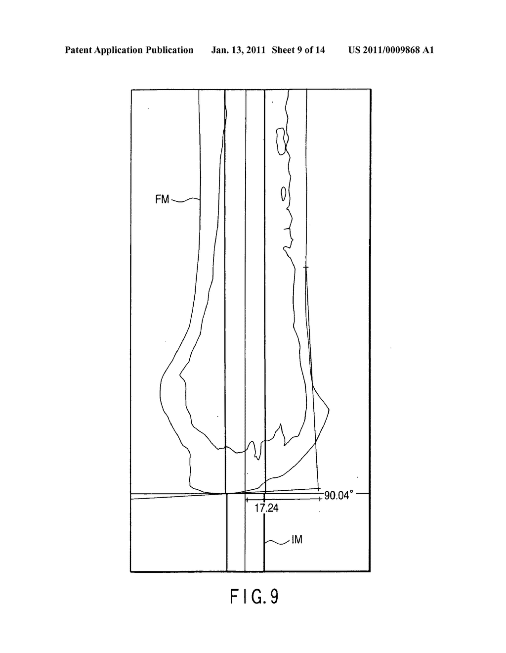 Apparatus for preoperative planning of artificial knee joint replacement operation and jig for supporting operation - diagram, schematic, and image 10