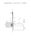 apparatus for spinal fusion diagram and image