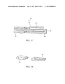 apparatus for spinal fusion diagram and image