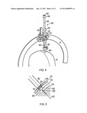 APPARATUS FOR STEREOTACTIC NEUROSURGERY diagram and image