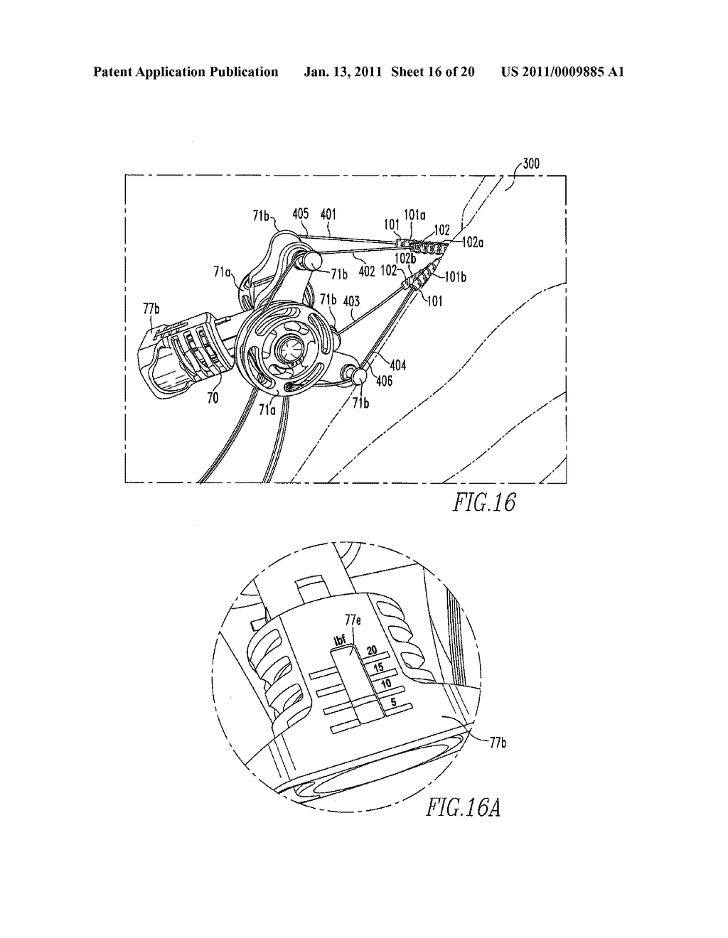 Tissue Graft Anchor Assembly and Instrumentation For Use Therewith - diagram, schematic, and image 17