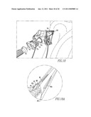 Tissue Graft Anchor Assembly and Instrumentation For Use Therewith diagram and image