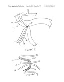 METHODS AND DEVICES FOR ENDOSCOPICALLY CREATING AN ANASTOMOSIS diagram and image