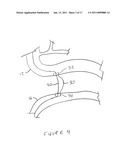 METHODS AND DEVICES FOR ENDOSCOPICALLY CREATING AN ANASTOMOSIS diagram and image