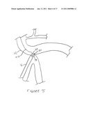 METHODS AND DEVICES FOR ENDOSCOPICALLY CREATING AN ANASTOMOSIS diagram and image