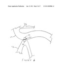 METHODS AND DEVICES FOR ENDOSCOPICALLY CREATING AN ANASTOMOSIS diagram and image