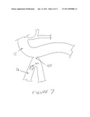 METHODS AND DEVICES FOR ENDOSCOPICALLY CREATING AN ANASTOMOSIS diagram and image