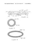 METHODS AND DEVICES FOR ENDOSCOPICALLY CREATING AN ANASTOMOSIS diagram and image