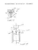 METHODS AND DEVICES FOR ENDOSCOPICALLY CREATING AN ANASTOMOSIS diagram and image