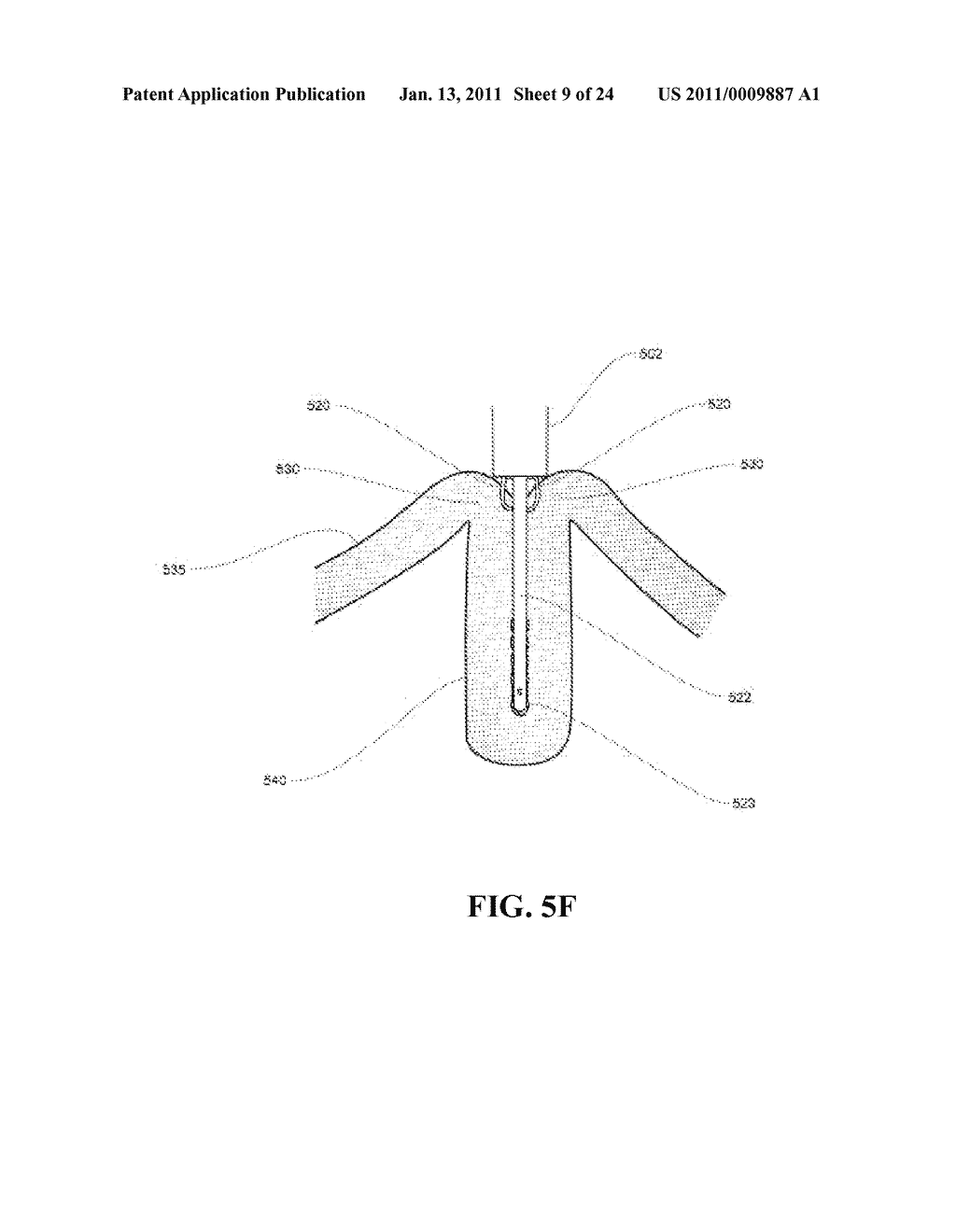 METHODS FOR REDUCING GASTRIC VOLUME - diagram, schematic, and image 10