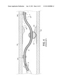 ROTATIONAL ATHERECTOMY SYSTEM WITH ENHANCED DISTAL PROTECTION CAPABILITY AND METHOD OF USE diagram and image