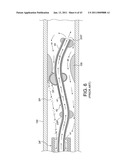 ROTATIONAL ATHERECTOMY SYSTEM WITH ENHANCED DISTAL PROTECTION CAPABILITY AND METHOD OF USE diagram and image