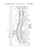 ROTATIONAL ATHERECTOMY SYSTEM WITH ENHANCED DISTAL PROTECTION CAPABILITY AND METHOD OF USE diagram and image