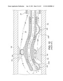 ROTATIONAL ATHERECTOMY SYSTEM WITH ENHANCED DISTAL PROTECTION CAPABILITY AND METHOD OF USE diagram and image