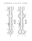 ROTATIONAL ATHERECTOMY SYSTEM WITH ENHANCED DISTAL PROTECTION CAPABILITY AND METHOD OF USE diagram and image