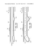 ROTATIONAL ATHERECTOMY SYSTEM WITH ENHANCED DISTAL PROTECTION CAPABILITY AND METHOD OF USE diagram and image