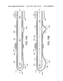 ROTATIONAL ATHERECTOMY SYSTEM WITH ENHANCED DISTAL PROTECTION CAPABILITY AND METHOD OF USE diagram and image