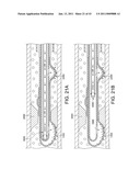 ROTATIONAL ATHERECTOMY SYSTEM WITH ENHANCED DISTAL PROTECTION CAPABILITY AND METHOD OF USE diagram and image