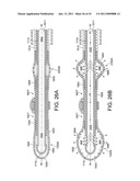 ROTATIONAL ATHERECTOMY SYSTEM WITH ENHANCED DISTAL PROTECTION CAPABILITY AND METHOD OF USE diagram and image