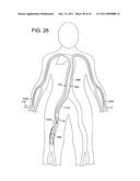 ROTATIONAL ATHERECTOMY SYSTEM WITH ENHANCED DISTAL PROTECTION CAPABILITY AND METHOD OF USE diagram and image