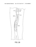 ROTATIONAL ATHERECTOMY SYSTEM WITH ENHANCED DISTAL PROTECTION CAPABILITY AND METHOD OF USE diagram and image