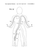 ROTATIONAL ATHERECTOMY SYSTEM WITH ENHANCED DISTAL PROTECTION CAPABILITY AND METHOD OF USE diagram and image