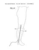 ROTATIONAL ATHERECTOMY SYSTEM WITH ENHANCED DISTAL PROTECTION CAPABILITY AND METHOD OF USE diagram and image