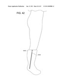 ROTATIONAL ATHERECTOMY SYSTEM WITH ENHANCED DISTAL PROTECTION CAPABILITY AND METHOD OF USE diagram and image