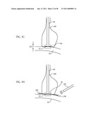 Methods and Devices to Treat Obesity diagram and image