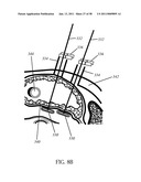 Methods and Devices to Treat Obesity diagram and image