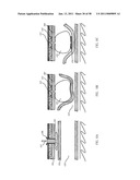 Methods and Devices to Treat Obesity diagram and image