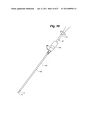 METAL VASCULAR APERTURE CLOSURE DEVICE diagram and image