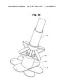 METAL VASCULAR APERTURE CLOSURE DEVICE diagram and image