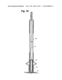 METAL VASCULAR APERTURE CLOSURE DEVICE diagram and image