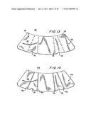 METHODS AND APPARATUSES FOR STABILIZING THE SPINE THROUGH AN ACCESS DEVICE diagram and image